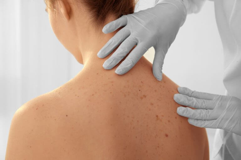 Bullous pemphigoid Recommended by Dr. Yeung Ho Hong 楊浩康